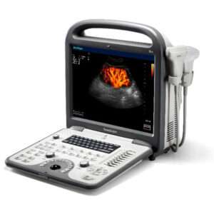 Portable color ultrasound S2/S6
